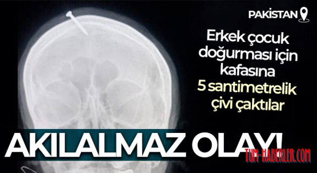 Erkek çocuk doğurması için hamile kadının kafasına çivi çaktılar