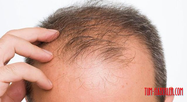 Kovid geçirenlerin saçını çıkaracak karışım tarifi