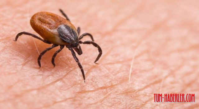 Kene ısırması belirtisi nasıl anlaşılır?